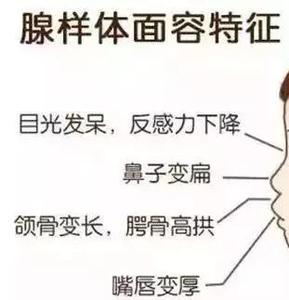 成都腺样体肥大手术费用是多少?